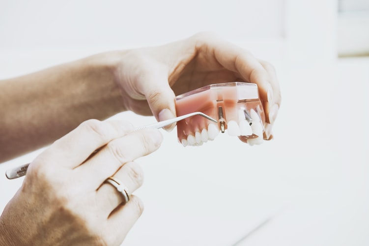 What Are the Primary Benefits of Invisalign Treatment?