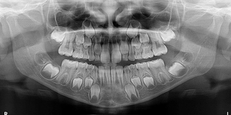 Comparing Carestream CBCT Models: Which Is Best for Me?