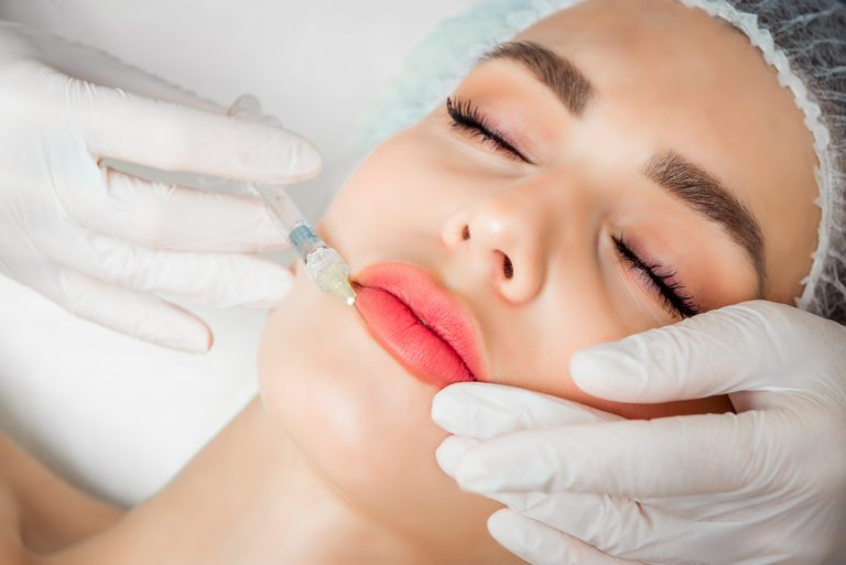 What to expect from a lip-filling treatment?