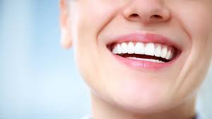 How to achieve the perfect teeth whitening in Noosa