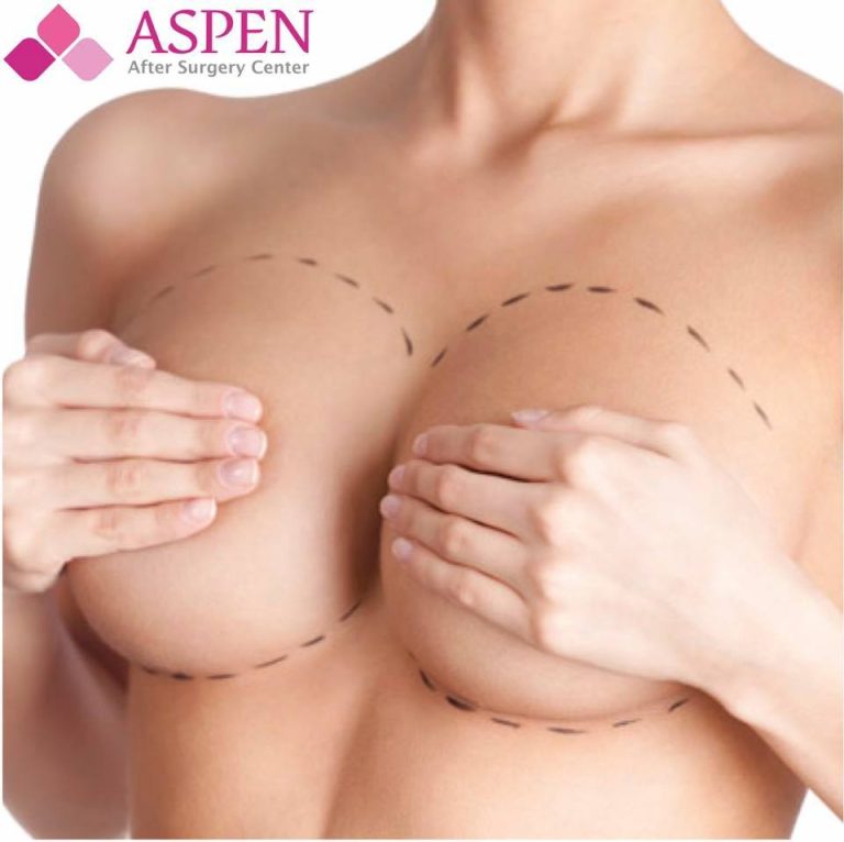 Breast Reconstruction Capsular Contracture: Causes and Treatment Options